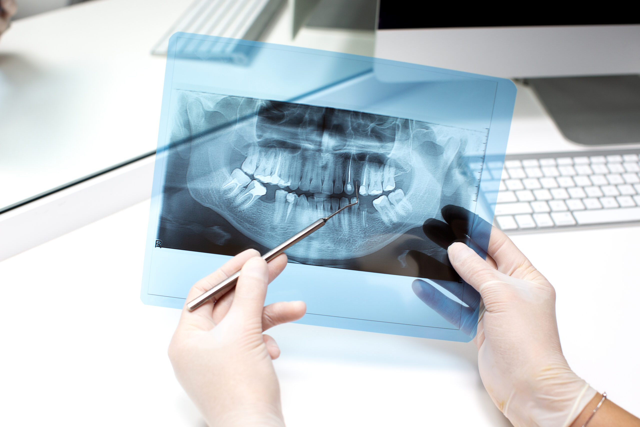 Rentgenodiagnostyka